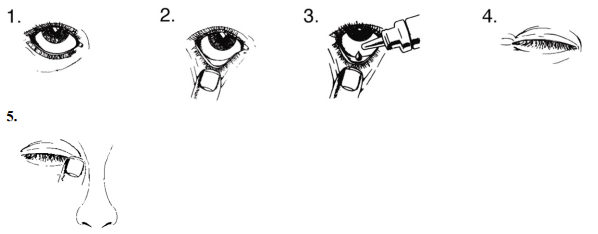 Ganfort® øjendråber, opløsning 0,3+5 mg/ml AbbVie Deutschland GmbH &amp; Co. KG