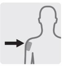 Trevicta® depotinjektionsvæske, suspension 175 mg, 263 mg, 350 mg og 525 mg Abacus Medicine A/S