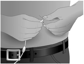 Xembify® injektionsvæske, opløsning 200 mg/ml Instituto Grifols S.A.