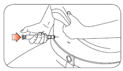 Abasaglar KwikPen Eli Lilly Nederland B.V. injektionsvæske, opløsning i fyldt pen 100 E/ML