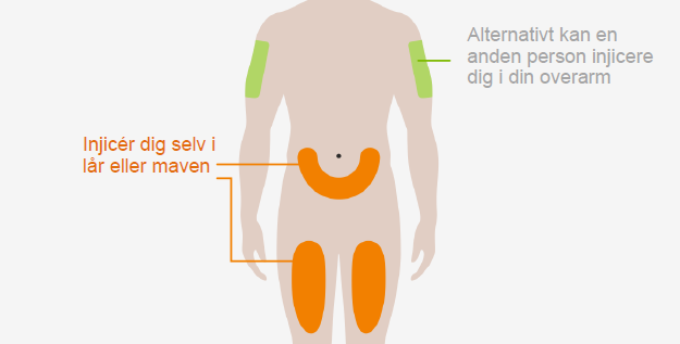Nucala GlaxoSmithKline Trading Services injektionsvæske, opløsning i fyldt injektionssprøjte 100 mg
