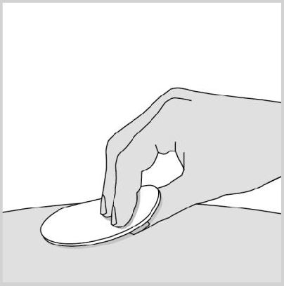 Metex Pen injektionsvæske, opløsning i fyldt pen 15 mg Abacus Medicine A/S