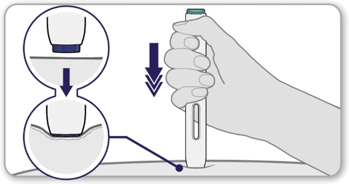 Enbrel® injektionsvæske, opløsning i fyldt pen 50 mg Abacus Medicine A/S