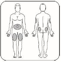 Humalog® Eli Lilly Netherland B.V. injektionsvæske, opl. 100 E/ml (cartridge