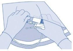 BCG medac pulver og solvens til intravesikal suspension  2care4 ApS