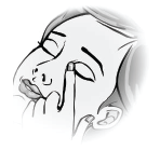 Cosopt iMulti Ukonserveret øjendråber, opløsning 20+5 mg/ml Ebb Medical AB