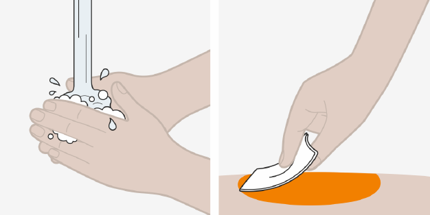 Nucala GlaxoSmithKline Trading Services injektionsvæske, opløsning i fyldt injektionssprøjte 100 mg