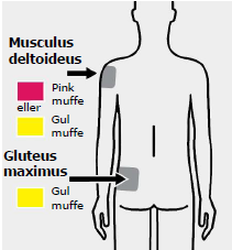 Trevicta® depotinjektionsvæske, suspension 175 mg, 263 mg, 350 mg og 525 mg Abacus Medicine A/S