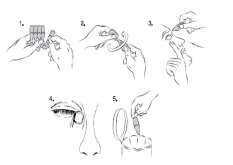 Ganfort 2care4 ApS øjendråber, opløsning, enkeltdosisbeholder 0,3+5 mg/ml