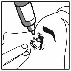 Travoprost/Timolol "Stada" STADA Arzneimittel AG øjendråber, opløsning 40 mikrog/ml+5 mg/ml