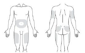 Subutex® depotinjektionsvæske, opløsning 100 mg og 300 mg Indivior Europe Limited