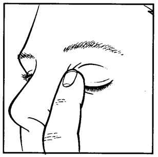 Travatan® øjendråber, opløsning 40 mikrogram/ml Medartuum AB