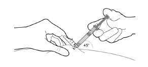 Subutex® depotinjektionsvæske, opløsning 100 mg og 300 mg Indivior Europe Limited