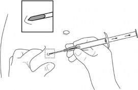 Leuprorelin "Sandoz" Sandoz A/S implantat, fyldt injektionssprøjte 5 mg
