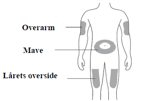 Osvyrti® injektionsvæske, opløsning i fyldt injektionssprøjte 60 mg Accord Healthcare S.L.U.