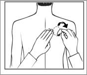 Exelon® Novartis Europharm Ltd., depotplastre 4,6 mg/24 timer, 9,5 mg/24 timer og 13,3 mg/24 timer