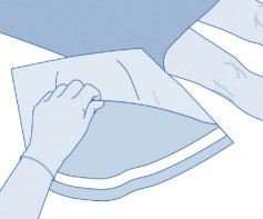 BCG medac pulver og solvens til intravesikal suspension  2care4 ApS