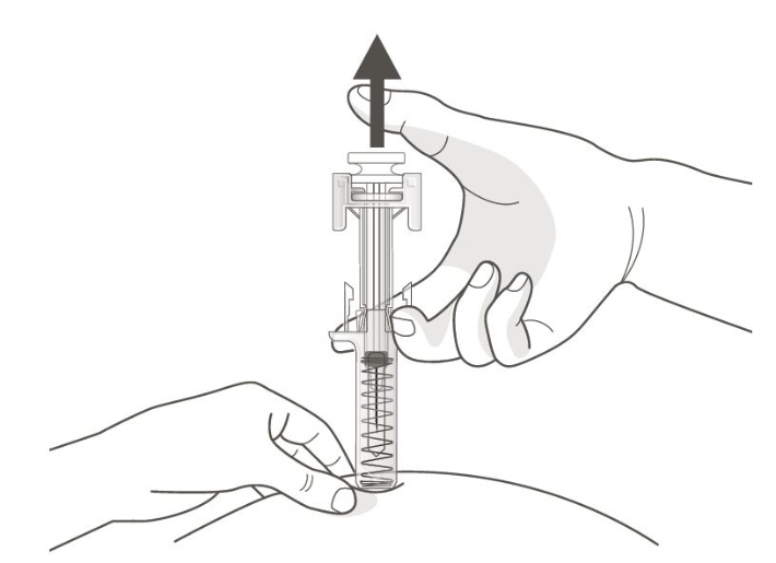 Obodence® injektionsvæske, opløsning i fyldt injektionssprøjte 60 mg Samsung Bioepis NL B.V.