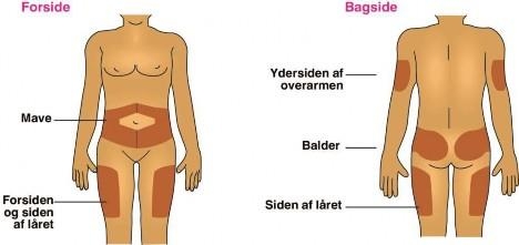 Semglee Orifarm A/S injektionsvæske, opløsning i fyldt pen 100 enheder/ml