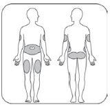Humalog KwikPen 2care4 ApS injektionsvæske, opløsning 100 E/ml (cartridge in pre-filled pen)