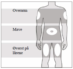 Junod® injektionsvæske, opløsning i fyldt injektionssprøjte 60 mg Gedeon Richter Plc.