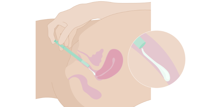 Medicin-som-bruges-i-skeden_applikator-creme-gel_v01_2025.02.14.png