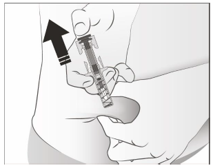 Junod® injektionsvæske, opløsning i fyldt injektionssprøjte 60 mg Gedeon Richter Plc.