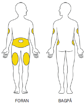 Trulicity injektionsvæske, opløsning i fyldt pen 0,75 mg Paranova Danmark A/S