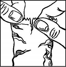 Travatan® øjendråber, opløsning 40 mikrogram/ml Medartuum AB