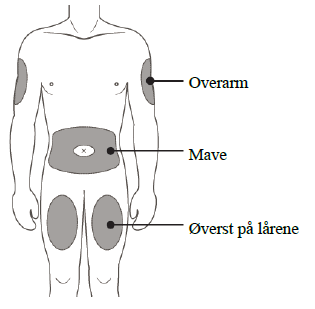 Obodence® injektionsvæske, opløsning i fyldt injektionssprøjte 60 mg Samsung Bioepis NL B.V.